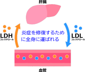 コレステロール・アイキャッチ